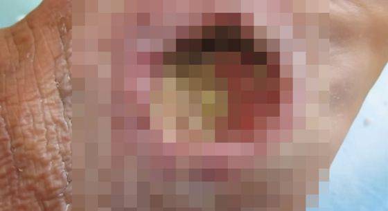 No image