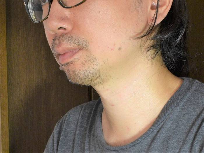 No image