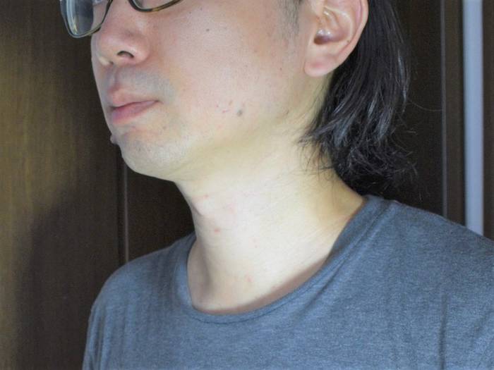 No image