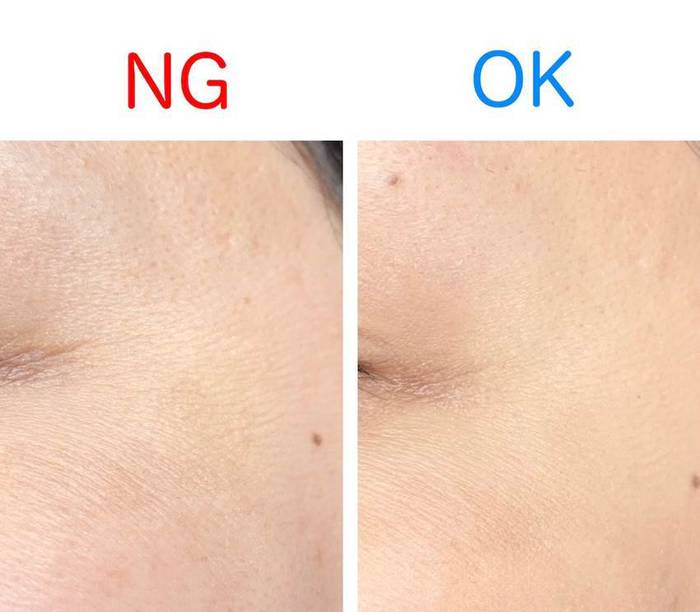 No image