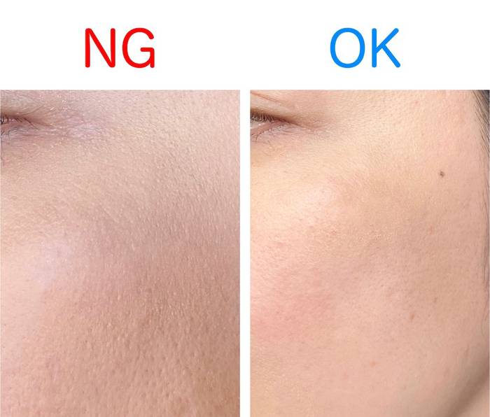 No image