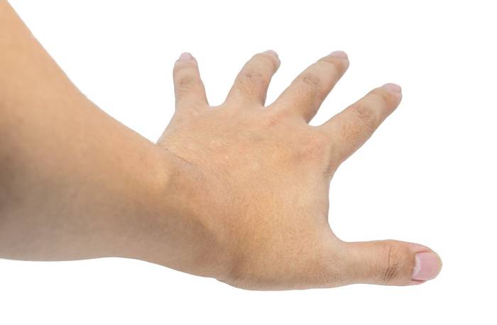 No image