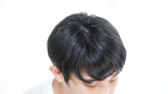 No image
